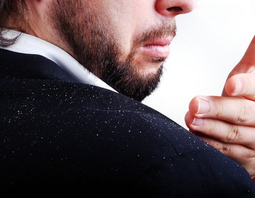 Atasi Rambut Berketombe dengan 3 Cara Ini