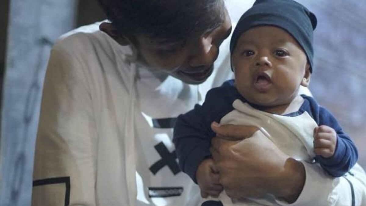 Penyebab Sindrom Williams yang Dialami Anak Dede Sunandar