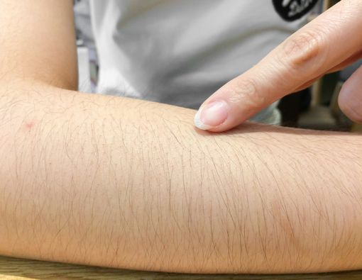 Wanita Punya Banyak Rambut Halus, Rentan Kena Penyakit Kesuburan?