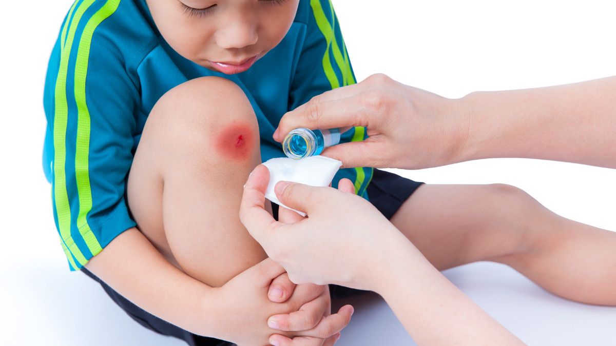 Tips Perawatan Luka Ringan di Rumah