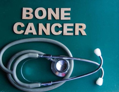 Faktor-Faktor Pemicu Kanker Tulang Primer