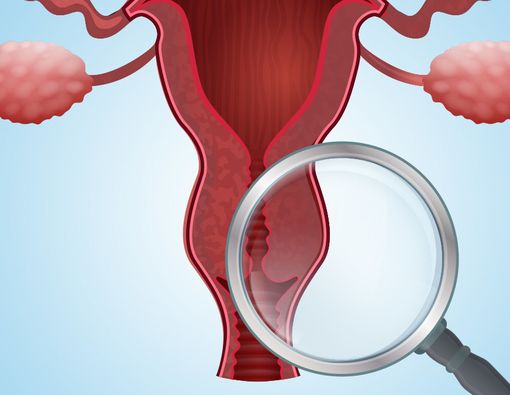 Lebih Akurat, Ini Alasan Tes HPV Lebih Unggul untuk Deteksi Kanker Serviks