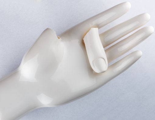 Bisakah Kusta Sembuh Total?