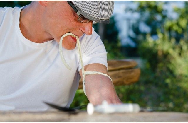 Pemakai Heroin Rentan Mengalami Masalah Gigi dan Mulut