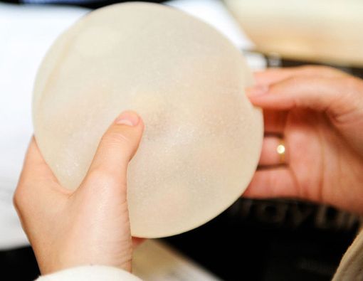 Apakah Implan Payudara Bisa Pengaruhi Kualitas ASI?