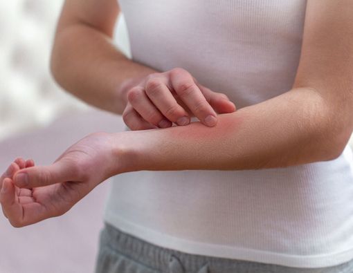 Pantangan Kulit Sensitif yang Mesti Dipatuhi