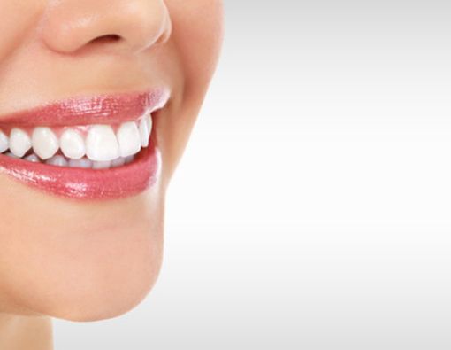 Fakta Memutihkan Gigi yang Perlu Anda Tahu
