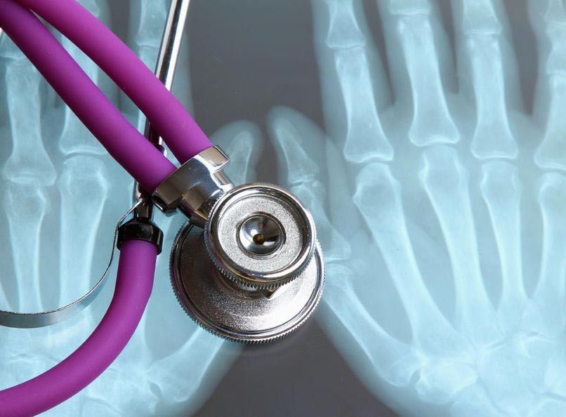 Beda Osteopenia dan Osteoporosis