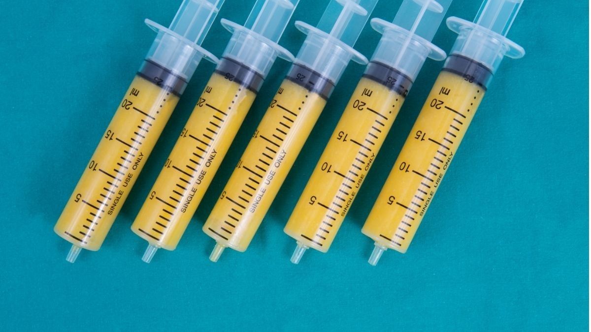 Apa Fat Transfer Lebih Aman dari Filler Payudara?