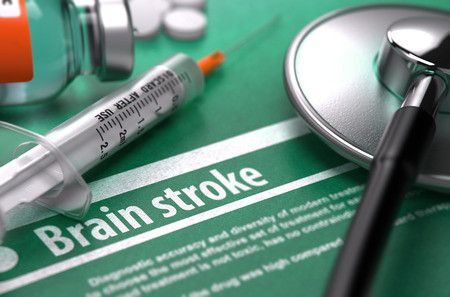Waspadalah! Stroke Mengincar Usia Lebih Muda