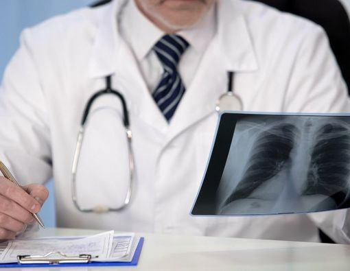 Catat! Ini Komplikasi Bronkitis yang Perlu Diwaspadai