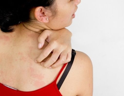 3 Penyakit yang Ditularkan Lewat Tangan