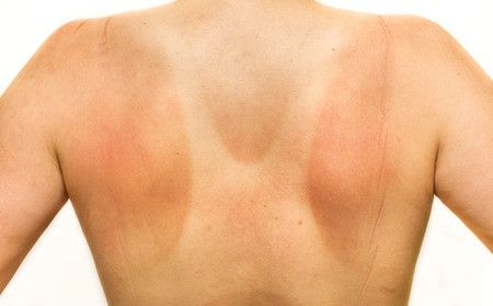 5 Kebiasaan Sehari-hari yang Merusak Kulit