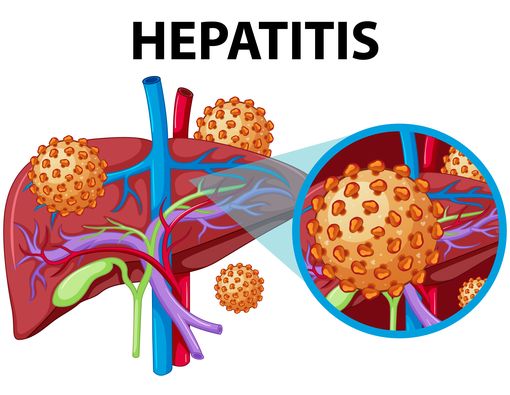 Mitos dan Fakta Seputar Hepatitis A dan B yang Masih Sering Salah Kaprah