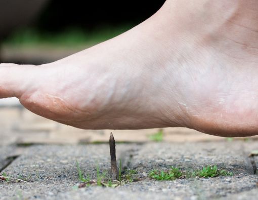 Cara Mencegah Tetanus Akibat Menginjak Paku Berkarat