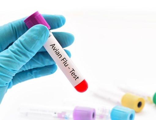 Ada Temuan Infeksi Flu Burung H10N3 pada Manusia, Apa Bahayanya?