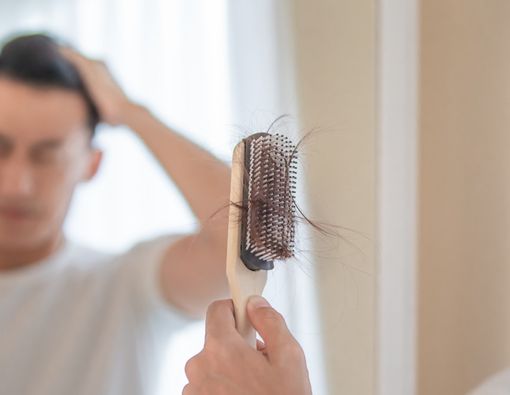 Mengenal Obat Penumbuh Rambut Minoxidil dan Finasteride