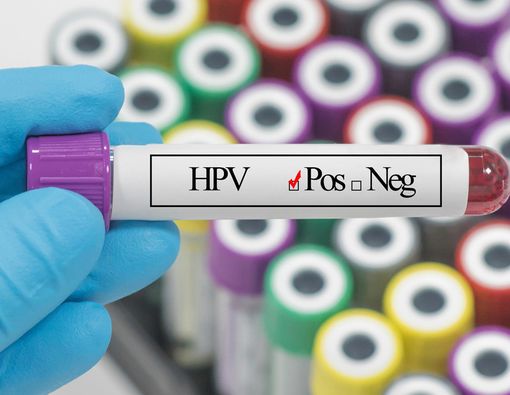 Positif HPV, Apakah Pasti Positif Kanker Serviks Juga?