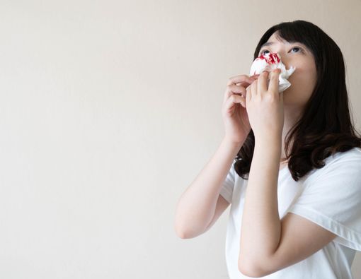 Jangan Sekali-kali Mendongakkan Kepala Saat Mimisan