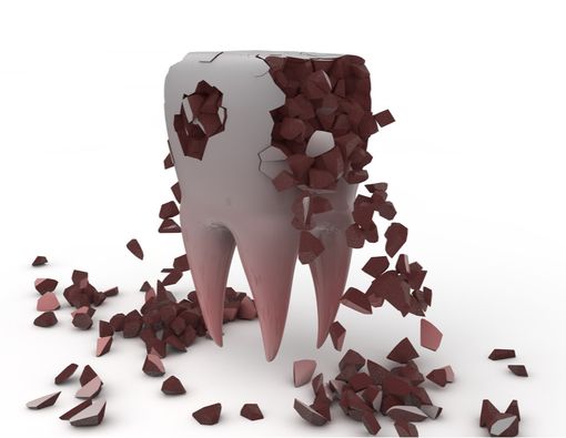 Abaikan Sakit Gigi Dapat Berujung Kematian