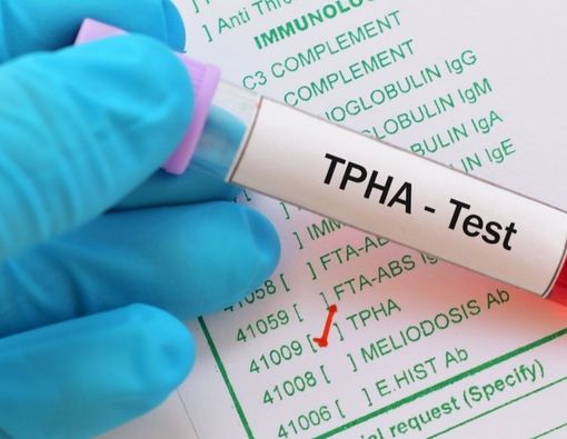 Mengenal Tes TPHA, Skrining Penyakit Sifilis