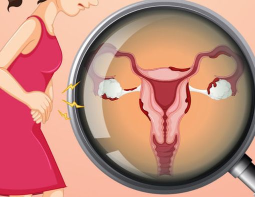 Pengaruh Diabetes terhadap Kesehatan Reproduksi