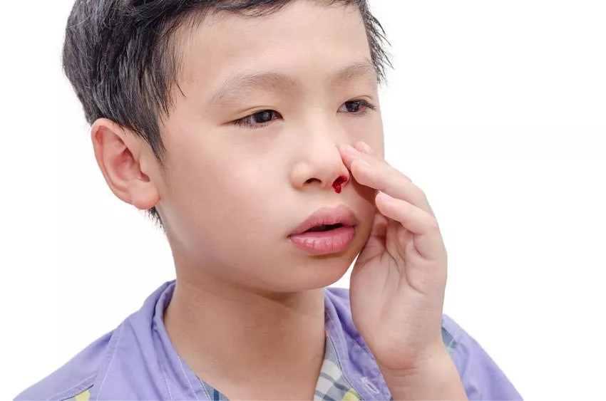 6 Cara Mudah Mengatasi Anak Mimisan