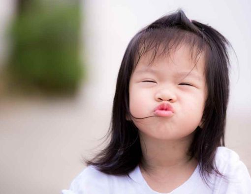 Ini 8 Faktor Penyebab Bibir Sumbing pada Bayi 