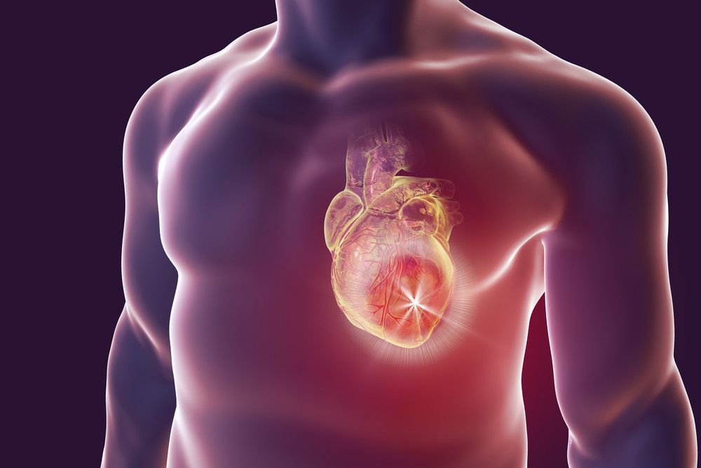 Kenali Beda Gagal Jantung, Henti Jantung, dan Serangan Jantung