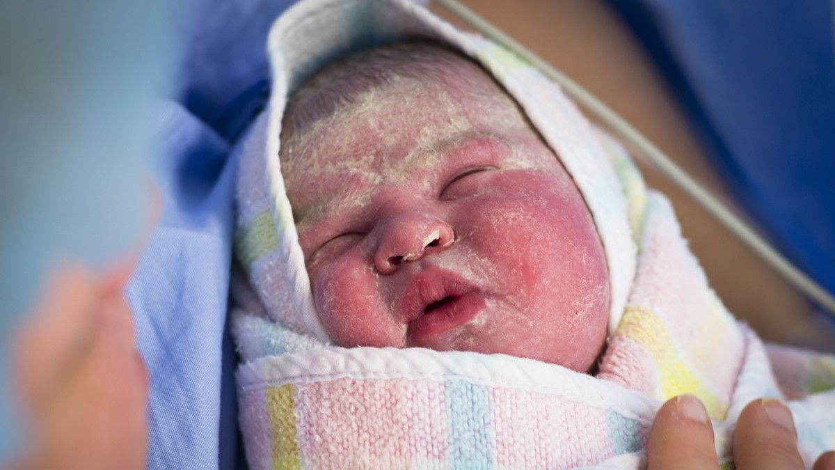 Penyebab Vernix Caseosa pada Bayi Baru Lahir