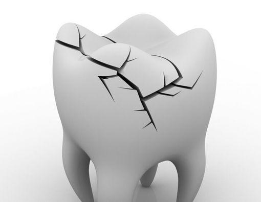 Daftar Makanan yang Bisa Bikin Gigi Anda Retak