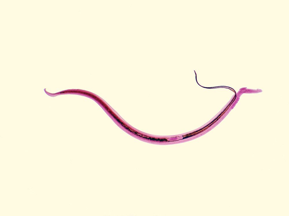Mengenal Schistosomiasis, Infeksi Cacing yang Mematikan