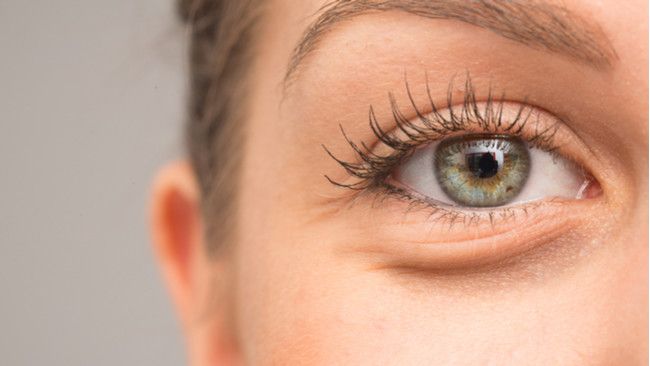 6 Tips Hilangkan Kantong Mata Secara Alami