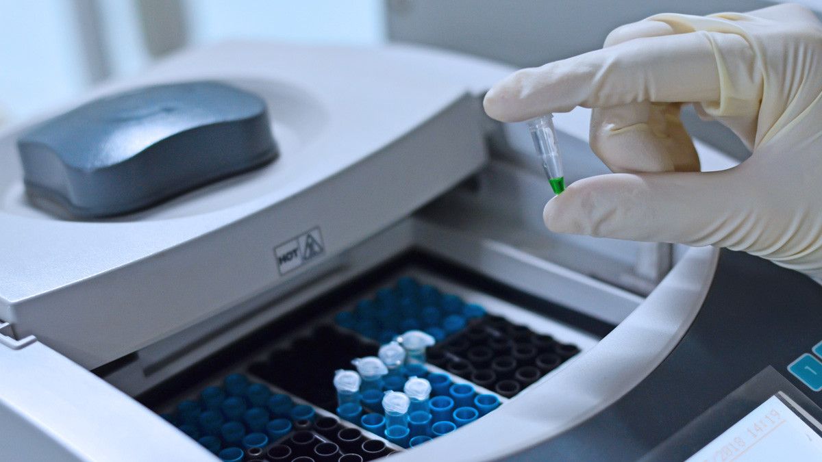 GYNPAD, Tes HPV dengan PCR untuk Deteksi Dini Kanker Serviks, Lebih Mudah dan Akurat!