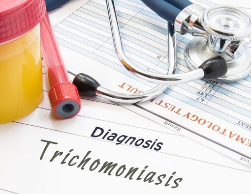 Trikomoniasis, Penyebab Keputihan Bewarna Hijau