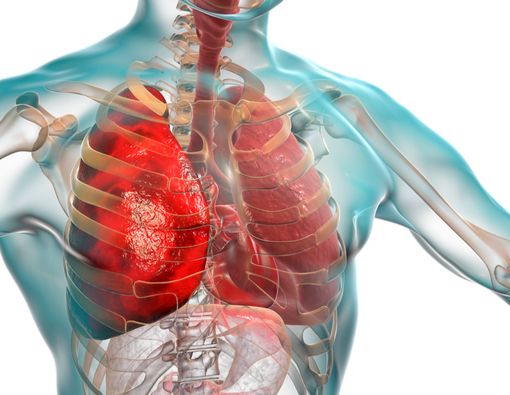 Faktor Risiko Pneumonia yang Wajib Kamu Waspadai