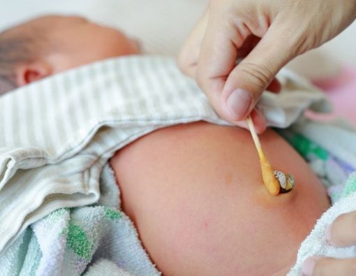 Cara Membersihkan Tali Pusat dan Pusar Bayi Baru Lahir