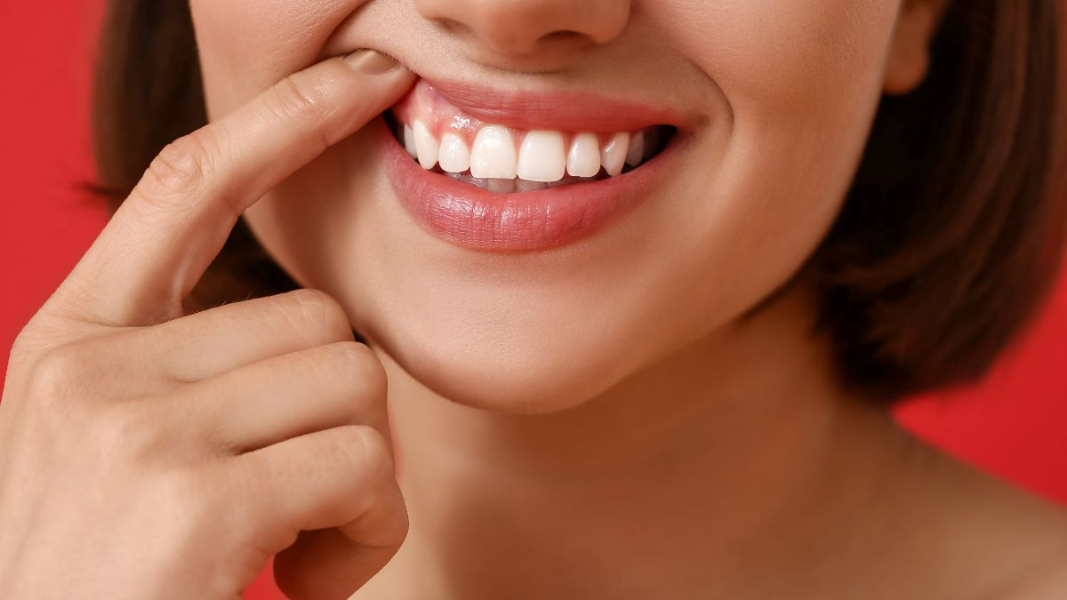 Cara Mengatasi Masalah Gusi Hitam