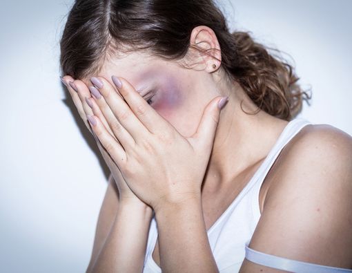 Kiat Menangani Luka dan Cedera pada Korban KDRT