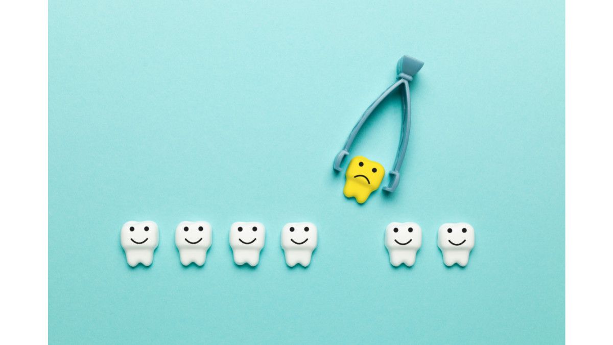 Merasa Kelelahan Setelah Cabut Gigi, Ini Penyebabnya