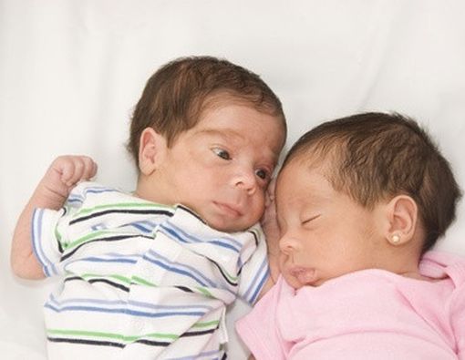 Mengenal Seluk-Beluk Kembar Siam