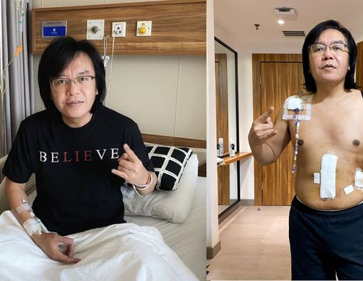 Penyebab Kanker Diffuse Large B-Cell Lymphoma (DLBCL)