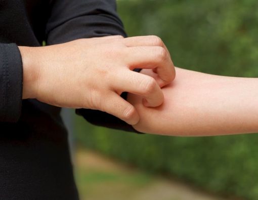 Daftar Jenis Makanan yang Harus Dihindari Pemilik Kulit Sensitif