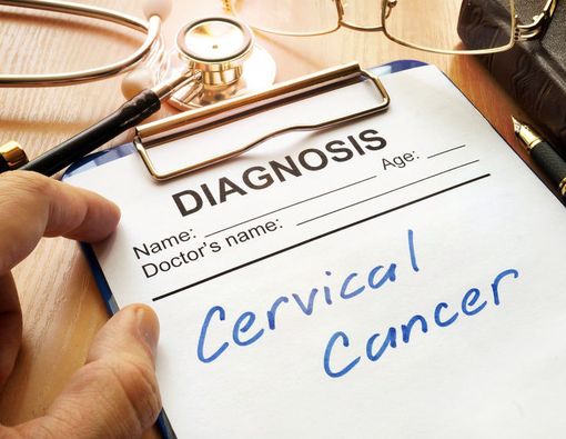 Fakta Terbaru Mengenai Kanker Serviks