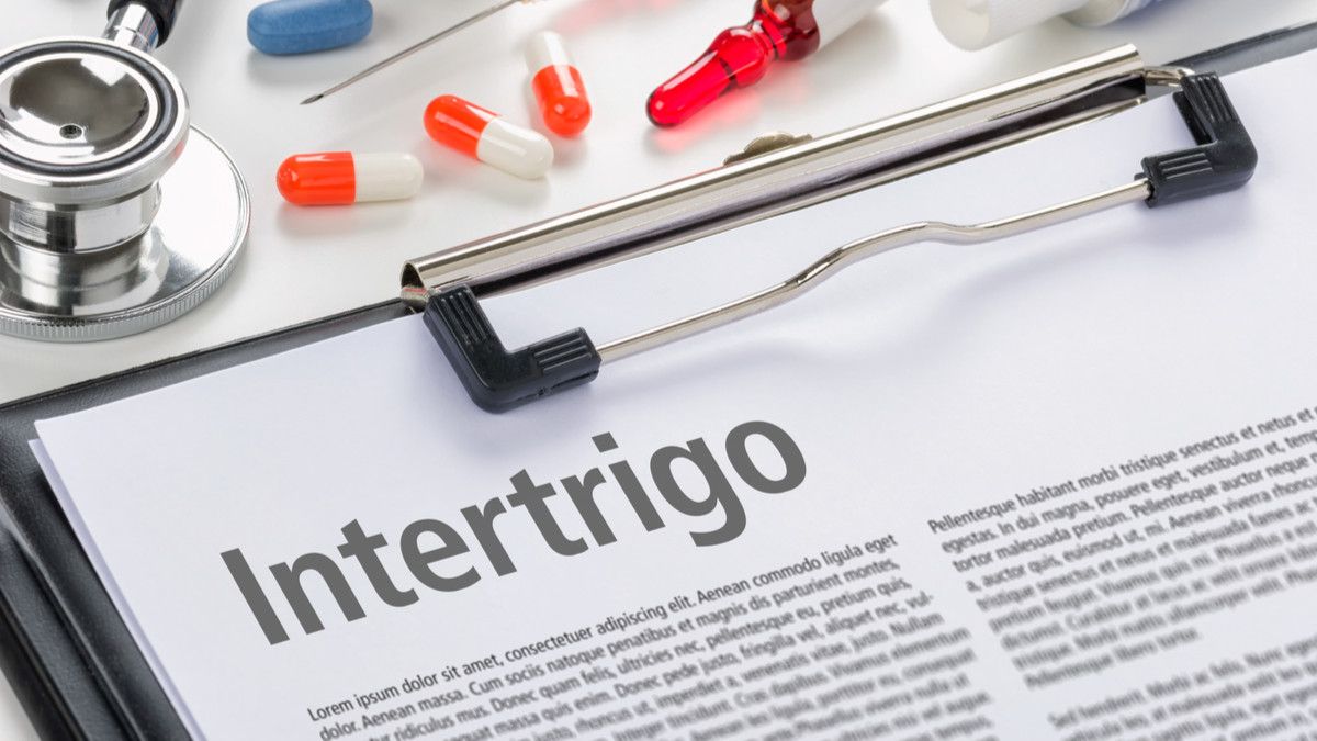 Mengenal Intertrigo, Peradangan Kulit pada Bayi