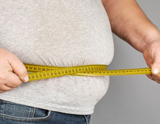 Penderita Obesitas Berisiko Terkena Batu Ginjal