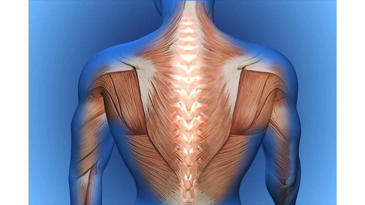 Kondisi Medis yang Bisa Picu Nyeri Punggung