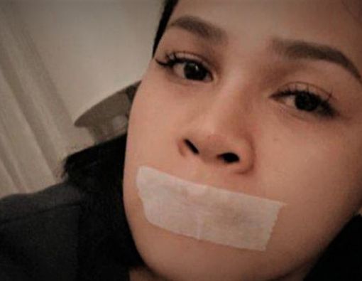 Tidur dengan Mulut Diplester seperti Andien, Adakah Manfaatnya?