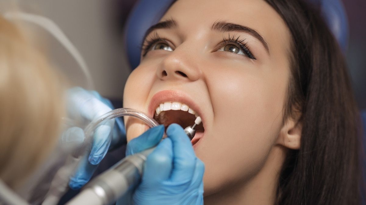 Hal yang Perlu Diketahui Soal Perawatan Polishing Gigi