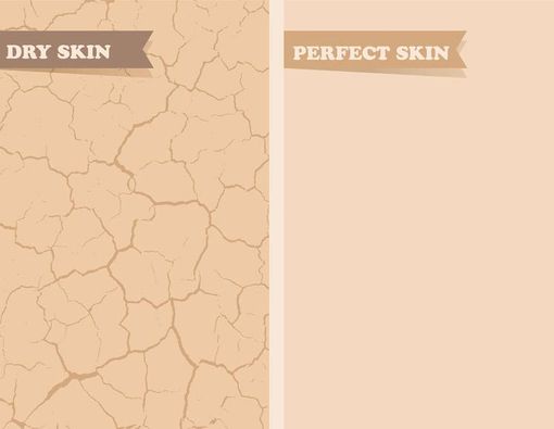 Kulit Kering dan Bersisik, Apa Artinya?